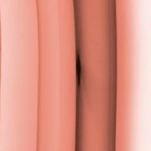 Roségold